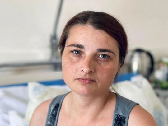 Пережила справжнє пекло: лікарі провели 6 операцій та врятували жінку, у якої рашисти на Великдень вбили сина та чоловіка