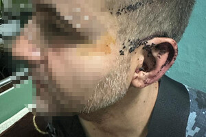 ДБР взялась за расследование избиение солдата в одной из воинских частей в Одесской области