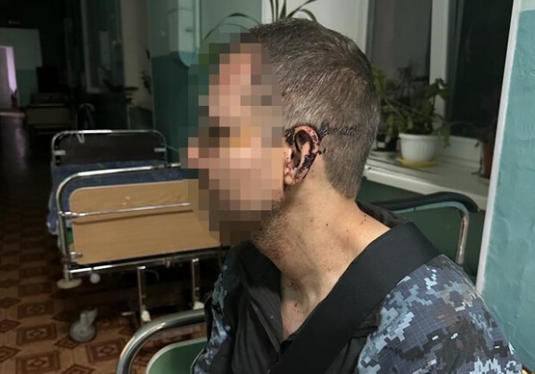 ДБР взялась за расследование избиение солдата в одной из воинских частей в Одесской области