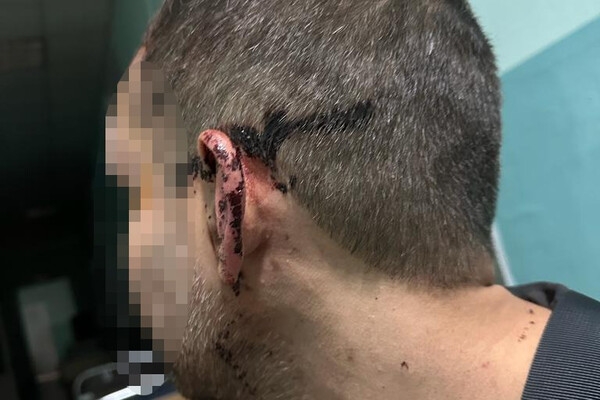 ДБР взялась за расследование избиение солдата в одной из воинских частей в Одесской области